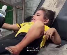 تصاویر غم‌انگیز از مجروح‌شدن کودک فلسطینی بر اثر حملات رژیم صهیونیستی