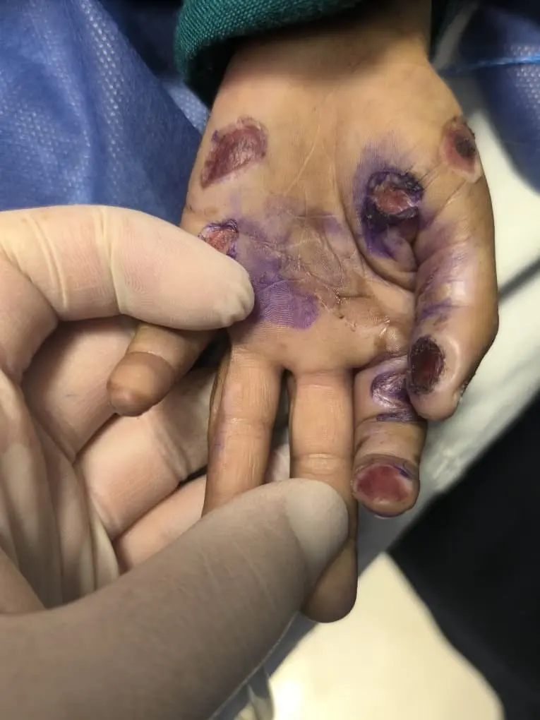 بچه 4 ساله هرمزگانی قربانی کودک‌آزاری شد