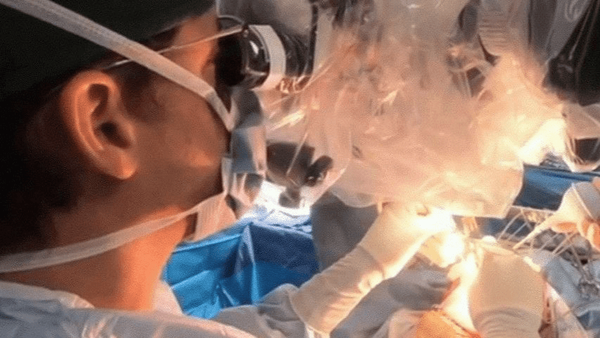 جراحی تومور مغزی کودک ۱۰ ساله در حالت بیداری