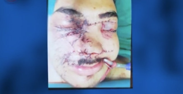 بدون تعارف با جوان دهه هشتادی که با جنایت تروریست‌های مسلح مجروح شد